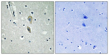 IL-1RI (phospho Tyr496) rabbit pAb