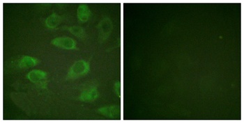 IL-2Rα (phospho Ser268) rabbit pAb