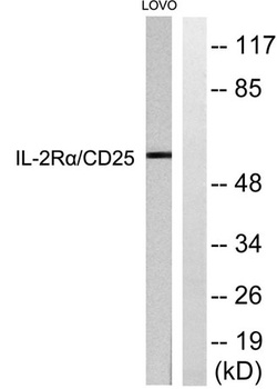 IL-2Rα rabbit pAb