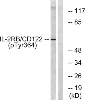 IL-2Rβ (phospho Tyr364) rabbit pAb