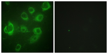 MRLC2 (phospho Ser20) rabbit pAb