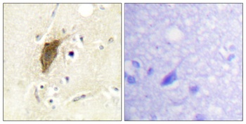 MRLC2 (phospho Ser20) rabbit pAb