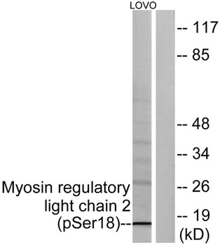 MRLC2 (phospho-Ser18) antibody