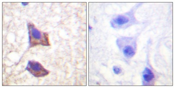 CD130 rabbit pAb