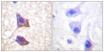 CD130 antibody