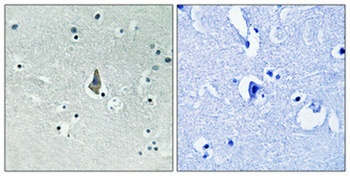 IL-8Rβ (phospho Ser347) rabbit pAb
