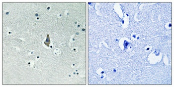 IL8R beta (phospho-Ser347) antibody