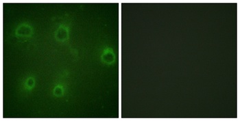 IL8R beta (phospho-Ser347) antibody