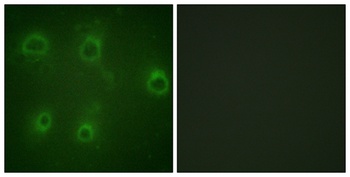 IL-8Rβ (phospho Ser347) rabbit pAb