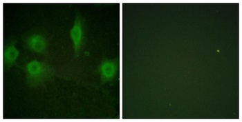 IL-9R (phospho Ser519) rabbit pAb