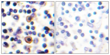 IL-9R (phospho Ser519) rabbit pAb