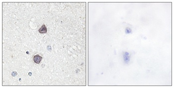 AQP2 (phospho-Ser256) antibody