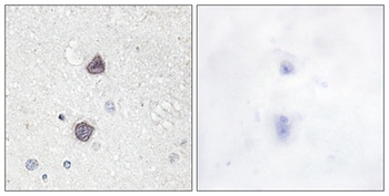 AQP2 (phospho Ser256) rabbit pAb