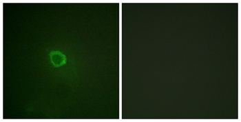 IL-13Rα1 (phospho Tyr405) rabbit pAb