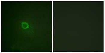 IL13R alpha 1 (phospho-Tyr405) antibody