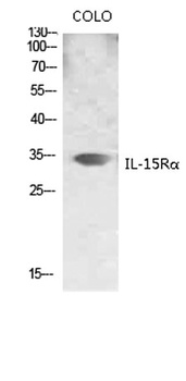 IL-15Rα rabbit pAb