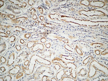 ILK antibody