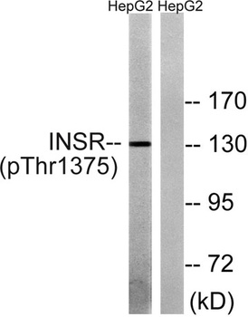 Insulin R (phospho-Thr1375) antibody