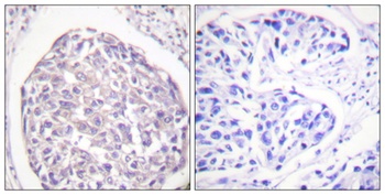 Insulin R (phospho Tyr1355) rabbit pAb