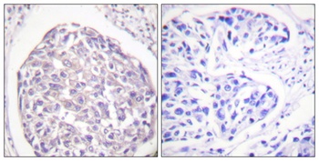 Insulin R (phospho-Tyr1355) antibody