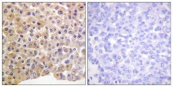 Insulin R (phospho Tyr1361) rabbit pAb