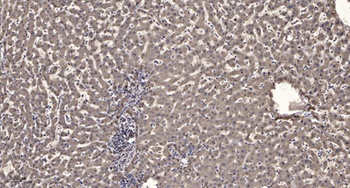 IRAK-1 (phospho Thr209) rabbit pAb