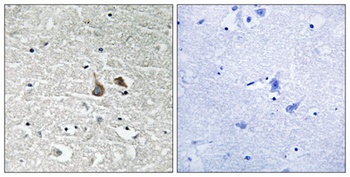 IRAK-1 (phospho Ser376) rabbit pAb