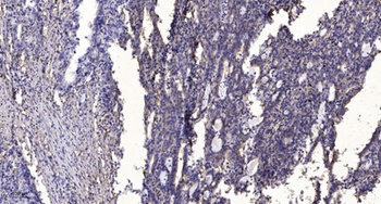 IRAK-1 (phospho Thr387) rabbit pAb