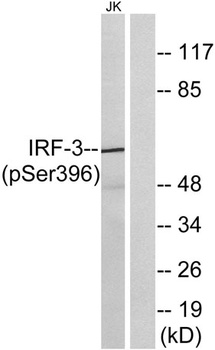 IRF-3 (phospho Ser396) rabbit pAb