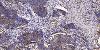 IRF-3 (phospho-Ser386) antibody