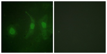 IRF-3 (phospho Ser385) rabbit pAb