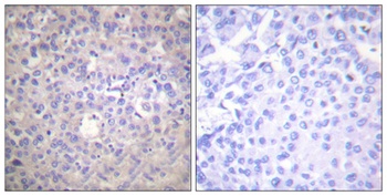 IRS-1 (phospho Ser616) rabbit pAb