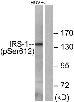 IRS-1 (phospho Ser616) rabbit pAb