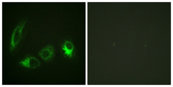 IRS-1 (phospho-Ser323) antibody
