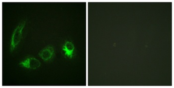 IRS-1 (phospho Ser323) rabbit pAb