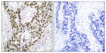 AR (phospho Ser213) rabbit pAb