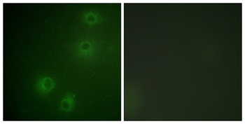 Integrin β1 (phospho Thr789) rabbit pAb