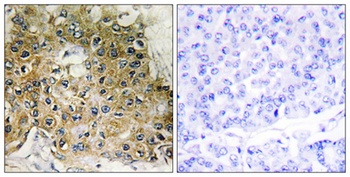 Integrin β1 (phospho Thr789) rabbit pAb