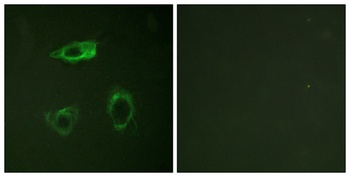 Integrin beta 2 (phospho-Thr758) antibody