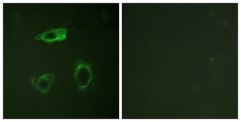 Integrin β2 (phospho Thr758) rabbit pAb