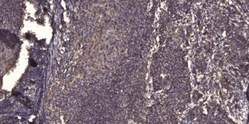 Integrin β2 (phospho Thr758) rabbit pAb
