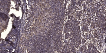 Integrin beta 2 (phospho-Thr758) antibody