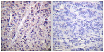 A-Raf (phospho-Tyr302) antibody