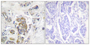 Integrin β4 (phospho Tyr1510) rabbit pAb
