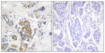 Integrin beta 4 (phospho-Tyr1510) antibody