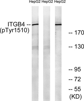 Integrin beta 4 (phospho-Tyr1510) antibody