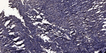 Cleaved-ITI-H4 70k (R661) rabbit pAb Antibody