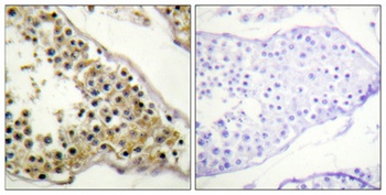 Emt (phospho Tyr512) rabbit pAb