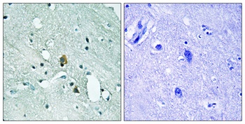 IP3R-I (phospho Ser1764) rabbit pAb