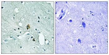 IP3R-I (phospho-Ser1764) antibody